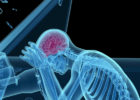 car accident lawyers - head and brain injuries