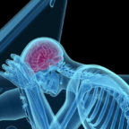 car accident lawyers - head and brain injuries