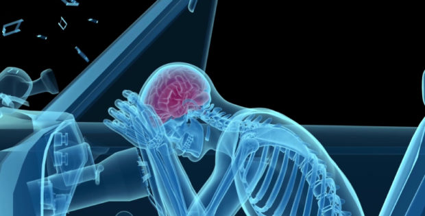 car accident lawyers - head and brain injuries