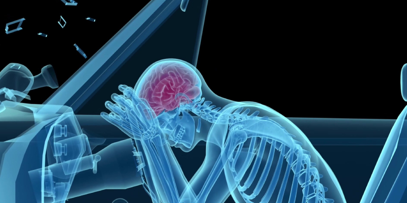 car accident lawyers - head and brain injuries